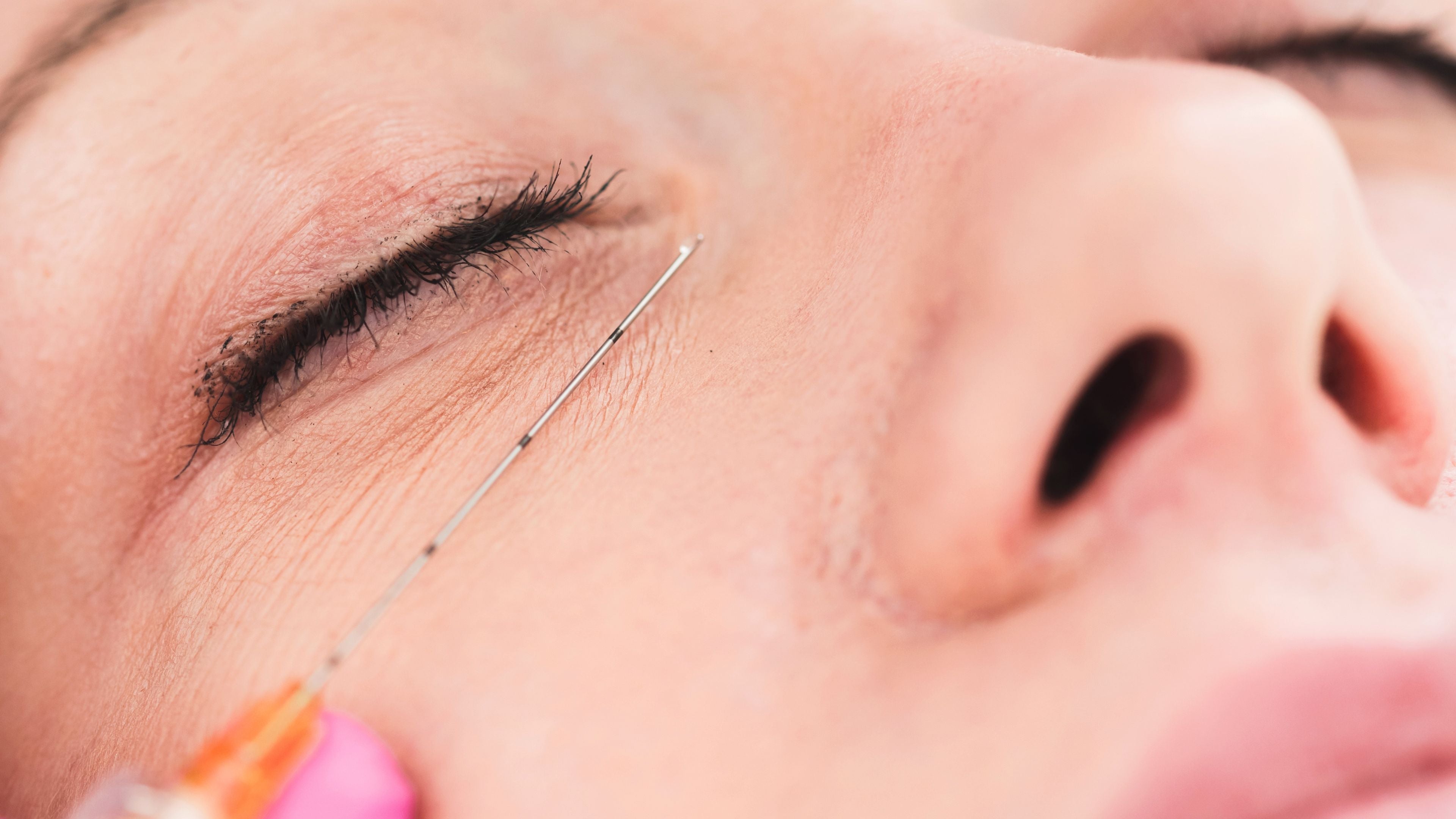 Feelsoft™ Micro Filler Cannulas