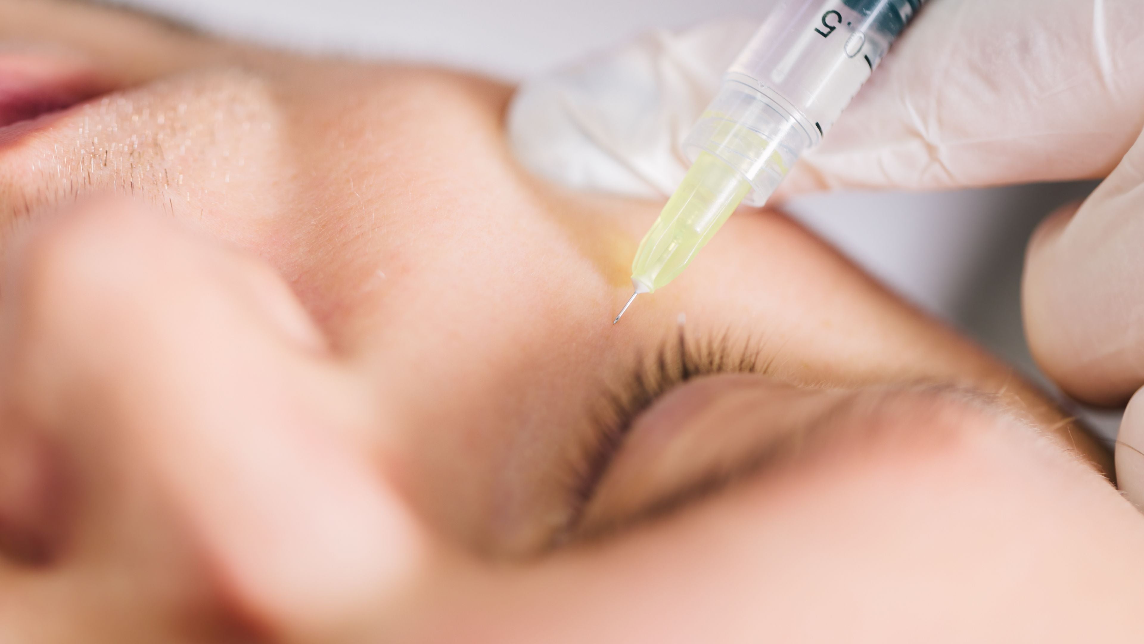 Feelsoft™ Meso Needles